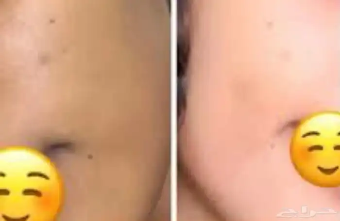 لكل انثى تبقى الجمال كريم مائي تبييض فوري من رشة وحدة بس 7