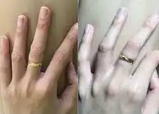 لكل انثى تبقى الجمال كريم مائي تبييض فوري من رشة وحدة بس 3