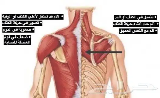أخصائي علاج طبيعي الابهر 4
