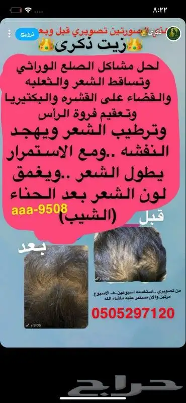 منتجاتي زيت ذكرى لشعر... ومشاط وحناء وسدر . 0