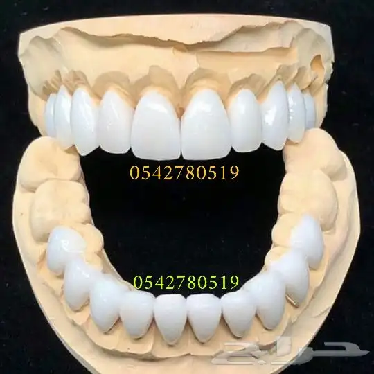 ابتسامة هوليود المتحركة 6
