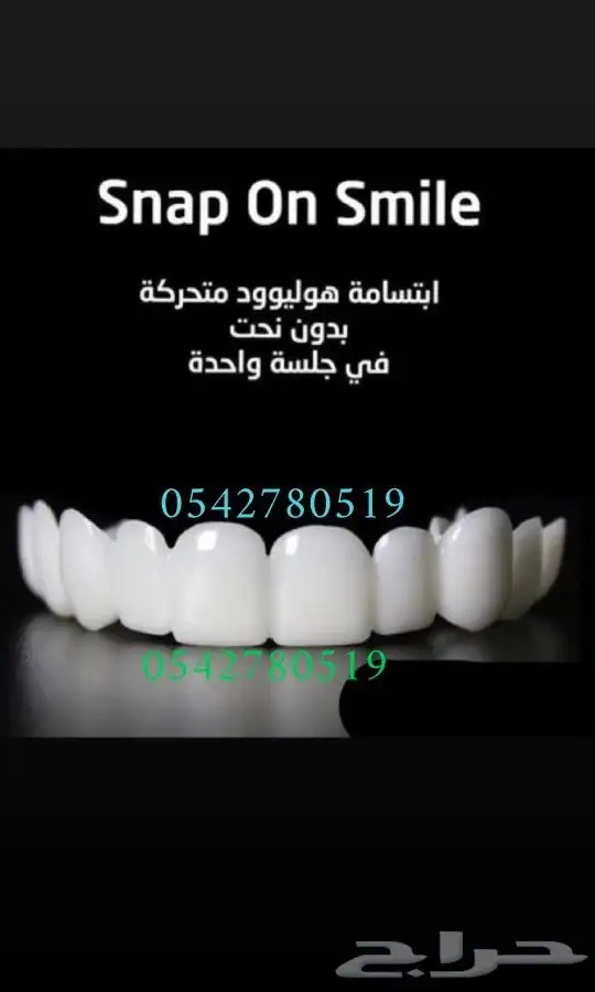 ابتسامة هوليود المتحركة 4