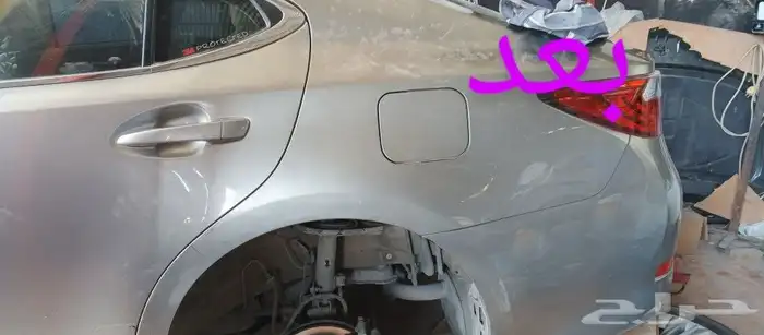 اخصائي شفط وتعديل بودي بدون بوية 2