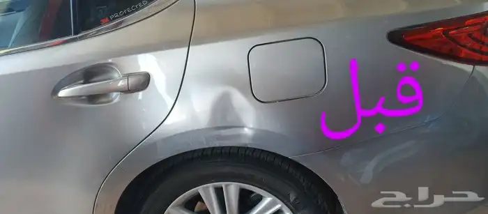 اخصائي شفط وتعديل بودي بدون بوية 1