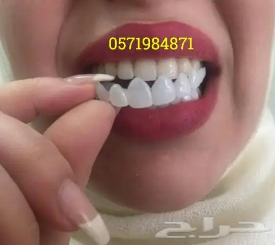 ابتسامة هوليود المتحركة 6