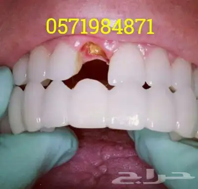 ابتسامة هوليود المتحركة 2