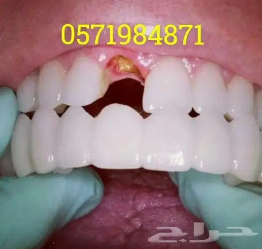 ابتسامة هوليود المتحركة 2