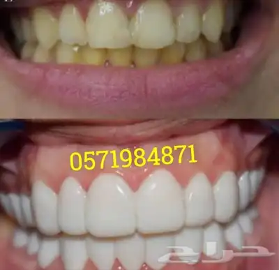 ابتسامة هوليود المتحركة 3
