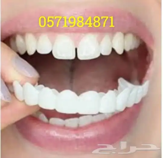 ابتسامة هوليود المتحركة 0