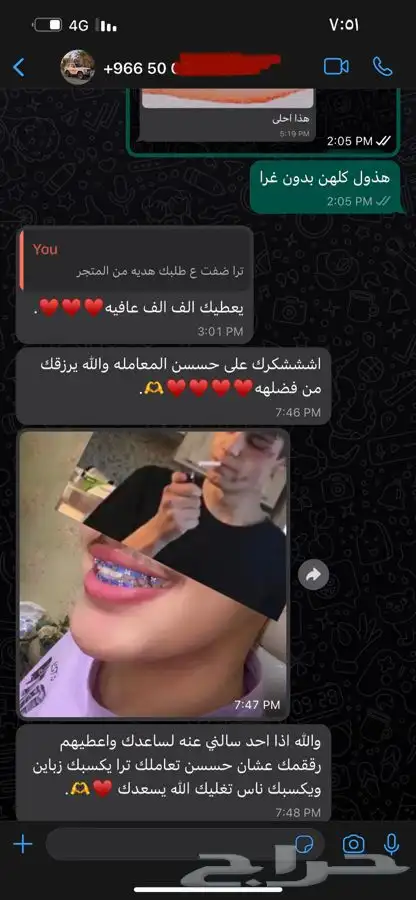 تقويم اسنان زينة تقويم اسنان زينه ب 39  عرض 1