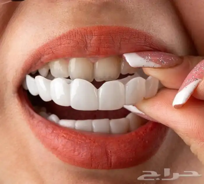 ابتسامة هوليود 0