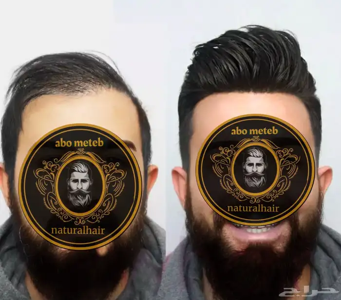 باروكة شعر (طبيعي) رجالي 6