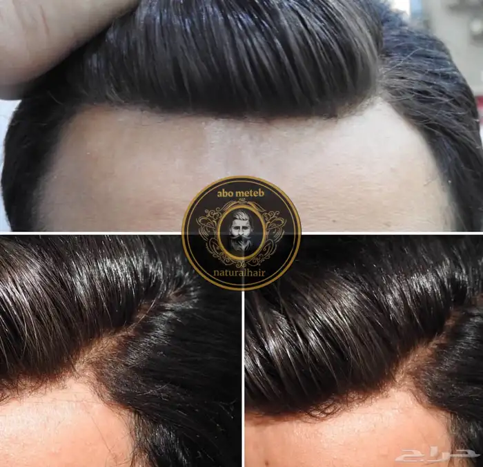 باروكة شعر (طبيعي) رجالي 17