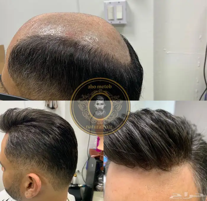 باروكة شعر (طبيعي) رجالي 11