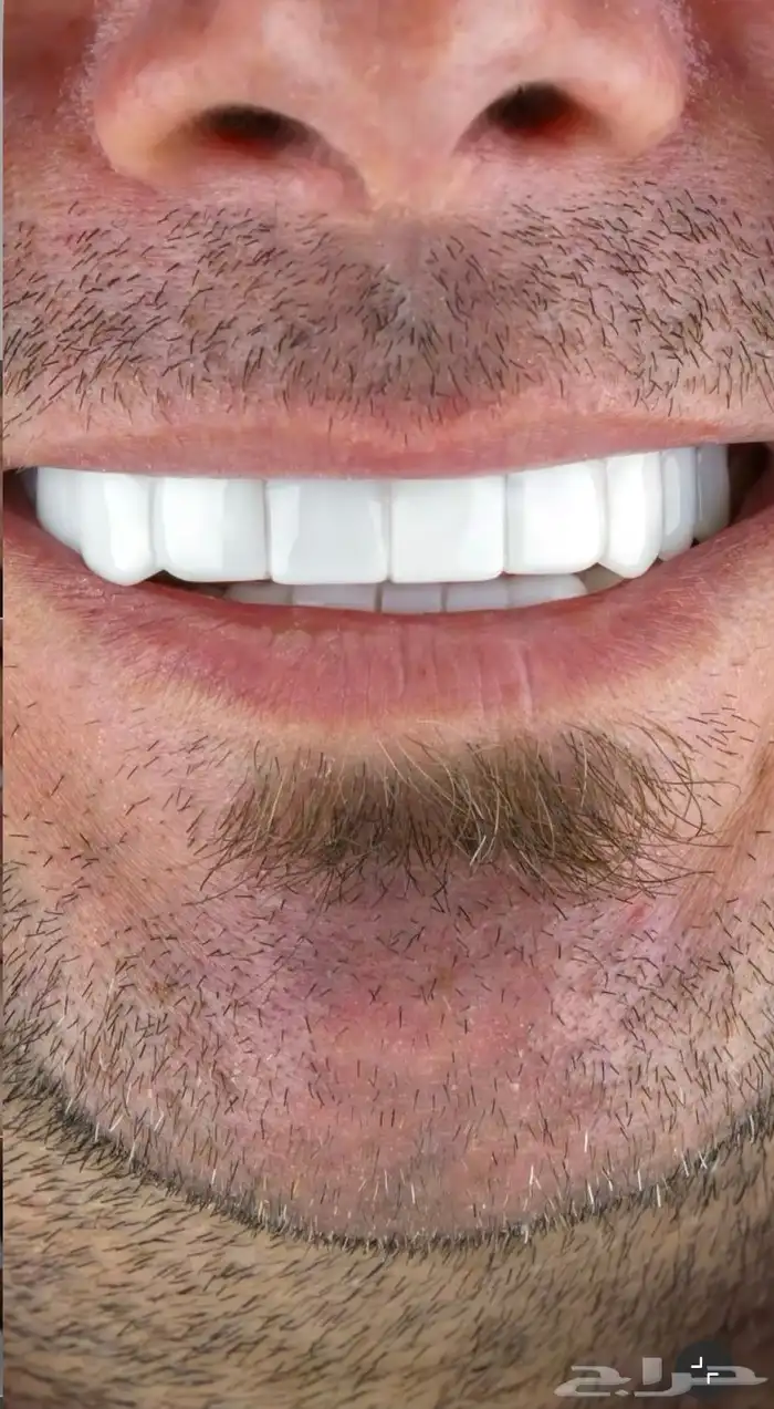 ابتسامة المشاهير 1