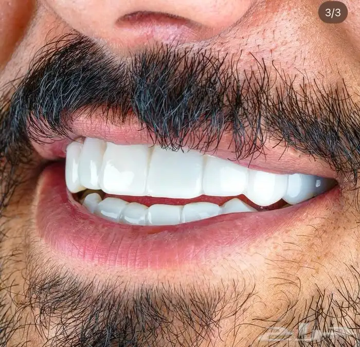 ابتسامة المشاهير 0