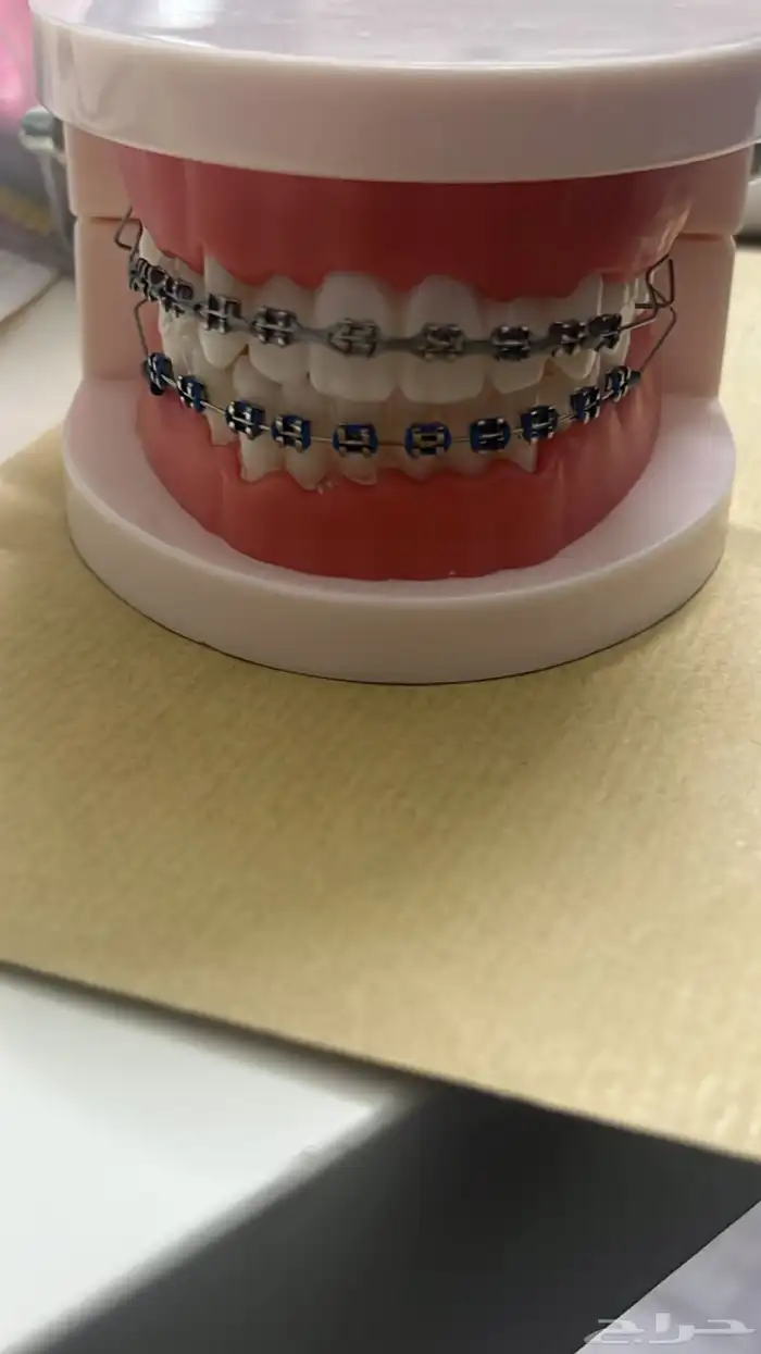 تقويم اسنان زينه 3