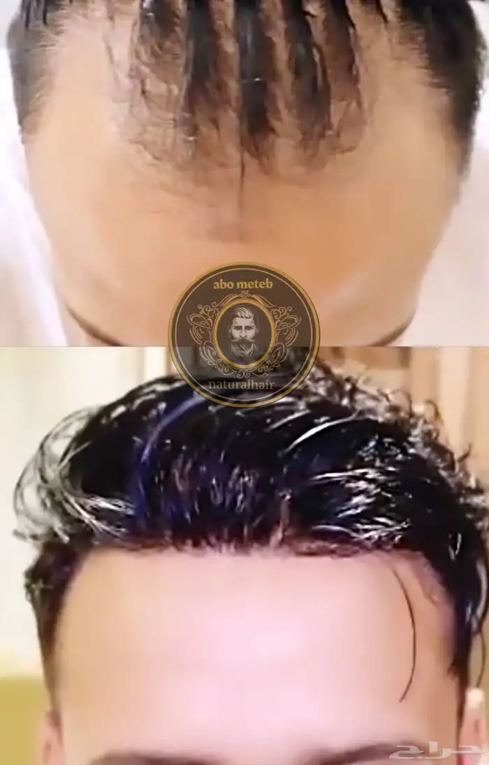 باروكة شعر (طبيعي) رجالي 8