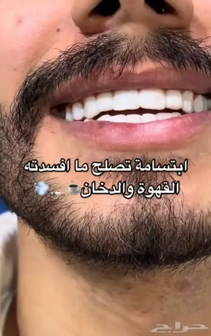 ابتسامة هوليود 0