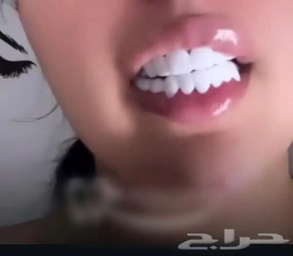 ابتسامة هوليود 1
