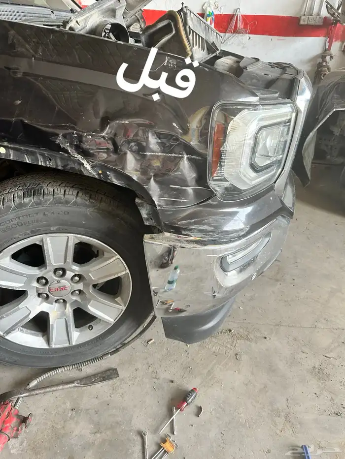 شفط وتعديل الصدمات علي البارد بدون بوهيا 0