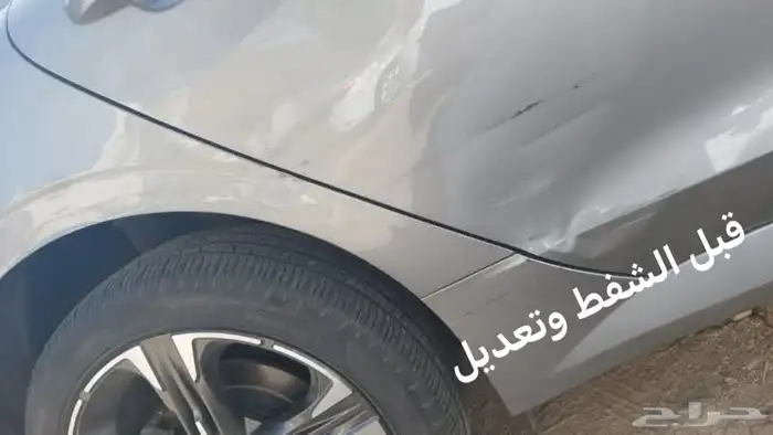 شفط وتعديل بارد بدون بوهيا 0