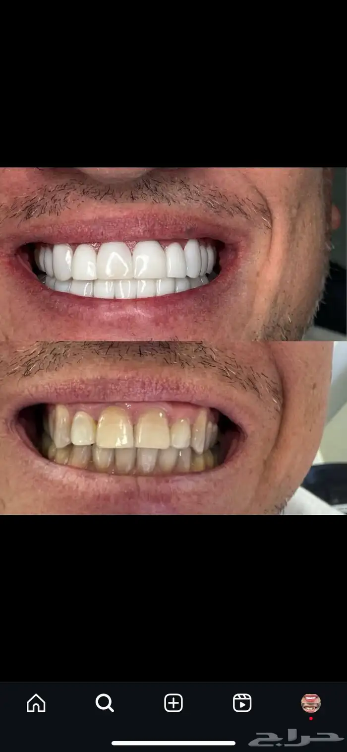 ابتسامة متحركة 1