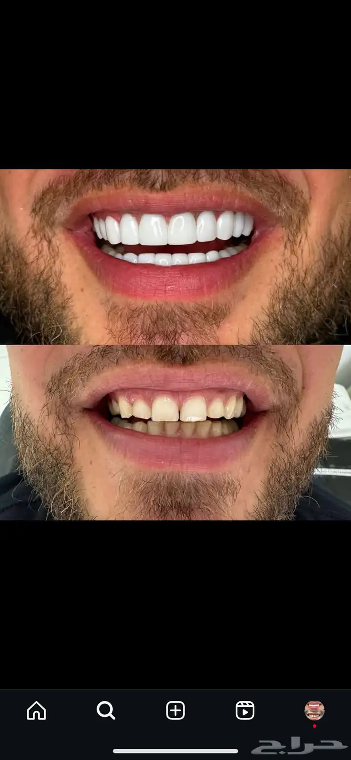 ابتسامة متحركة 3