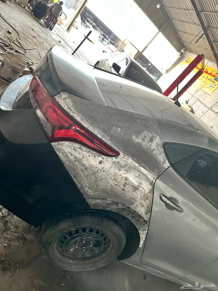 شفط_وتعديل سمكره ودهان 7
