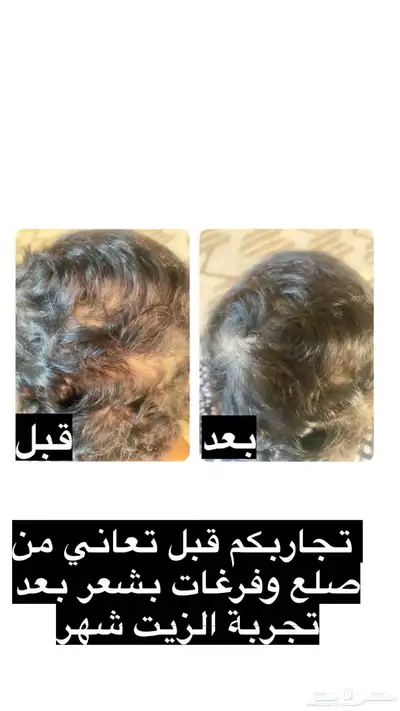 عنايه 8