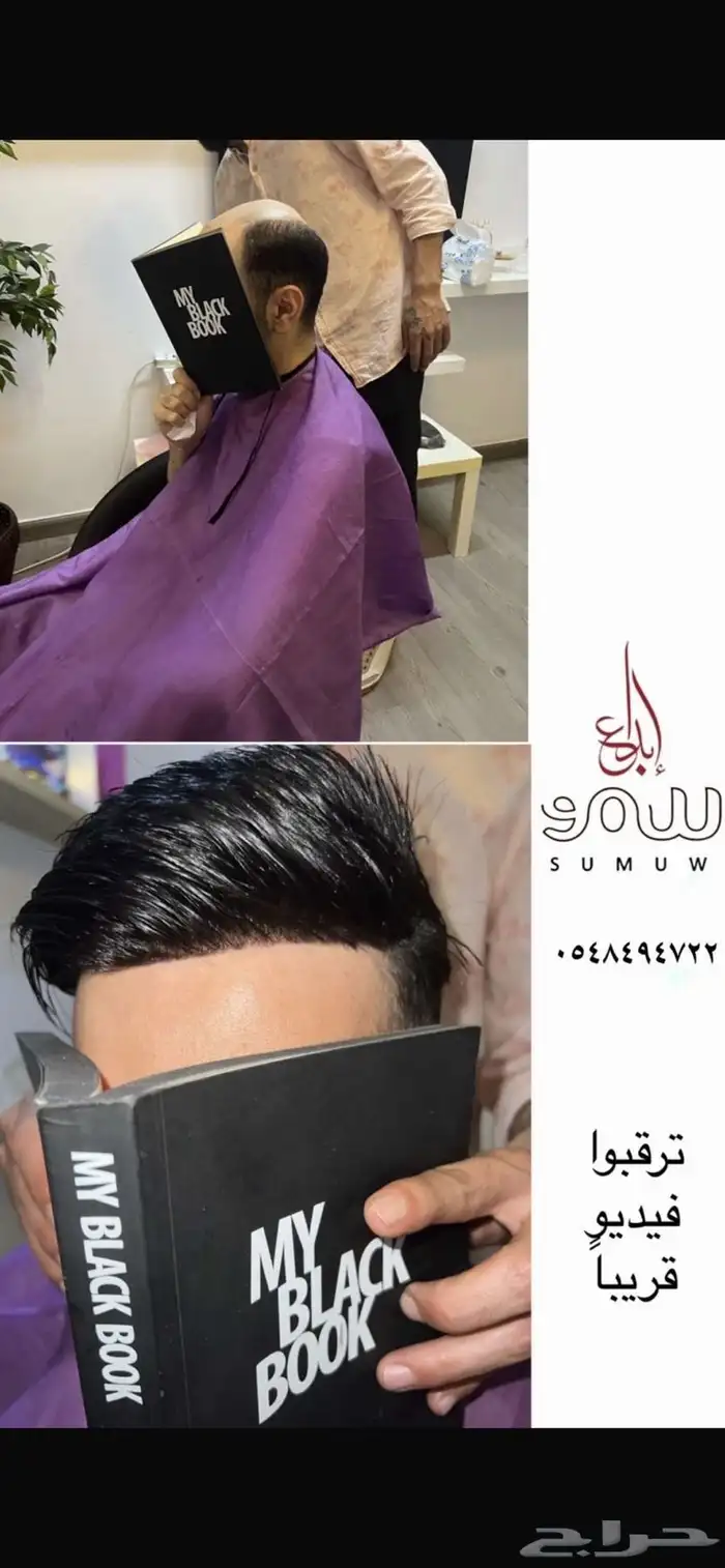 تركيب شبكيات شعر طبيعي بجوده عاليه من غير زراعه وعمليات 0