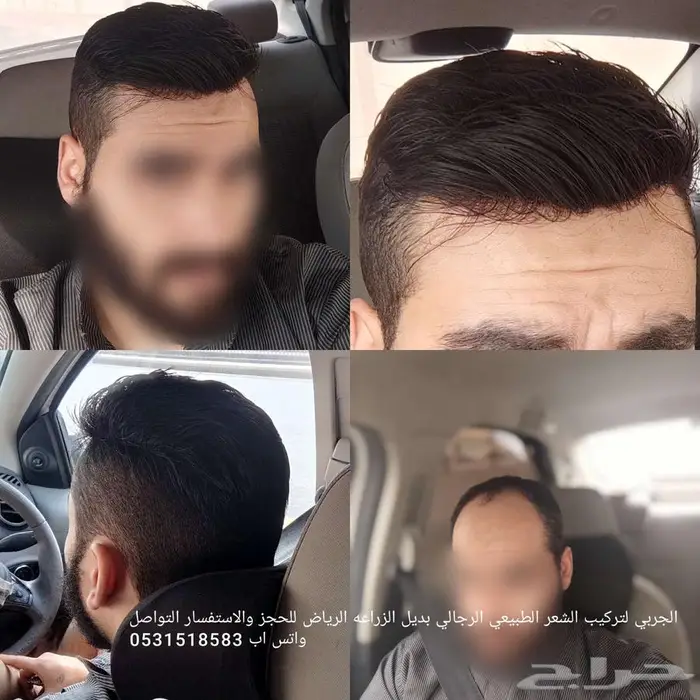بوستيجة باروكة رجالية دائمة 0