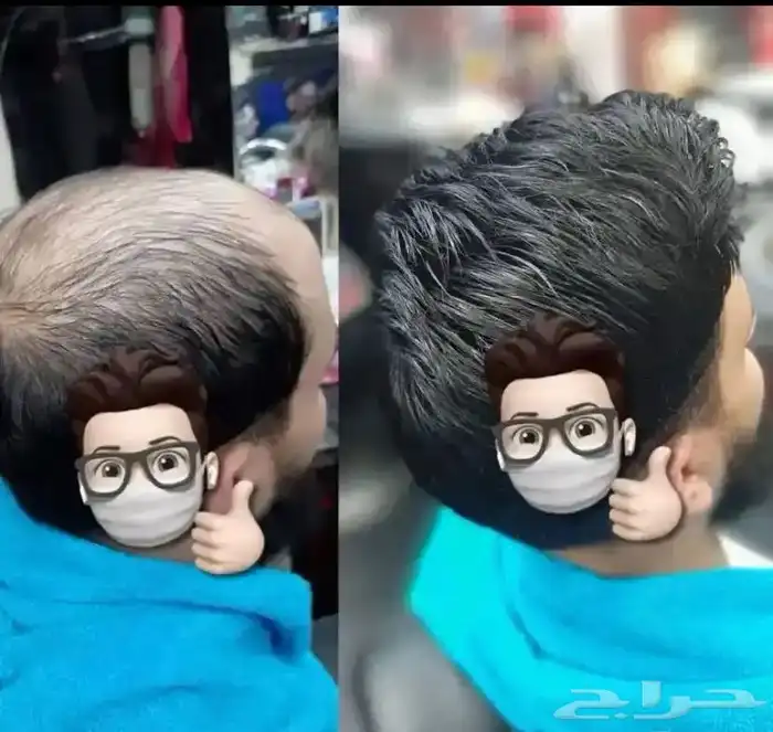 بواريك شعر رجالي طبيعي شبكيه استرالي وبرازيلي 10