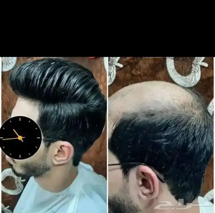 بواريك شعر رجالي طبيعي شبكيه استرالي وبرازيلي 9