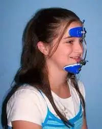 جهاز تعديل الفك السفلي للاطفال 2