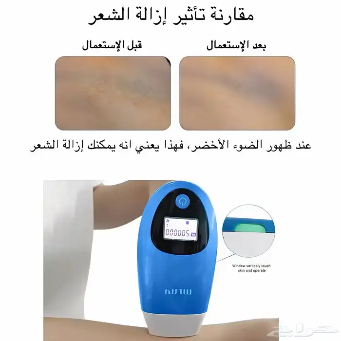 ليزر ملاي T3 عدسه(تكسير الاسعار) 3