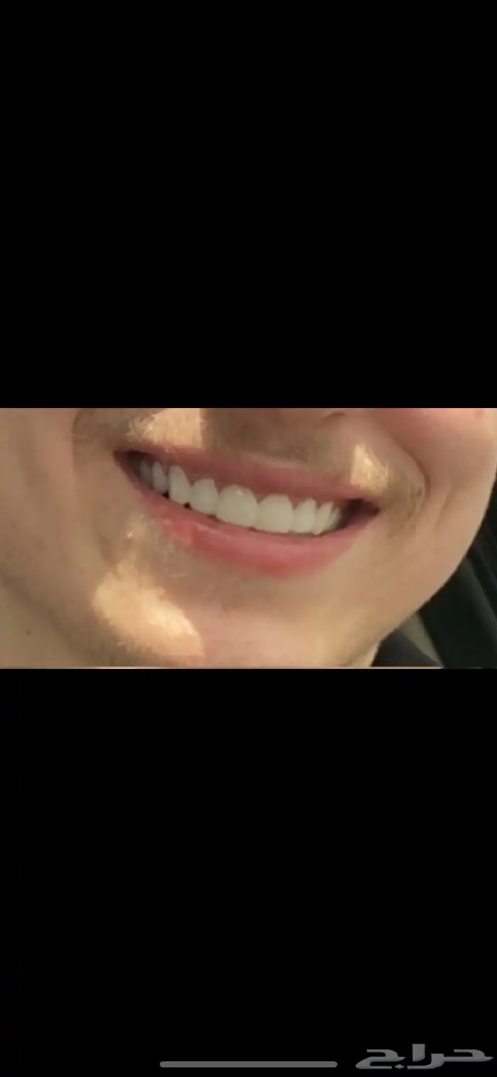 ايتسامة هوليود 2