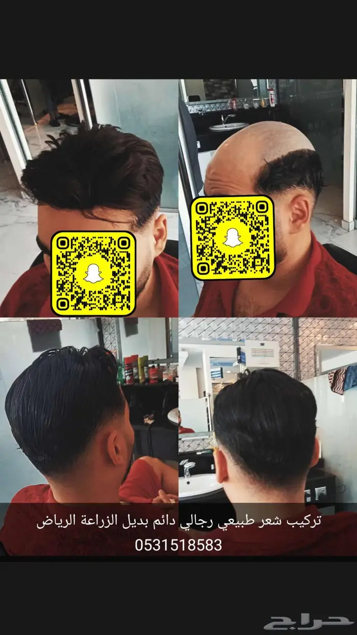 بروكة بوستيجة طبيعي دائم 10