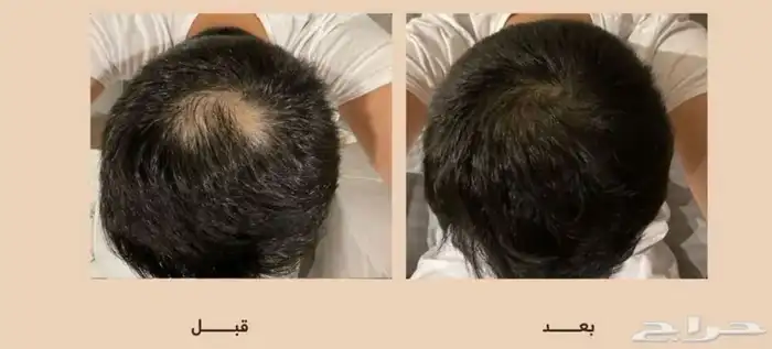 قسم بالله هالزيت طول وكثر شعري . 9