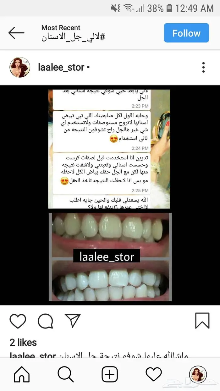 تبييض الاسنان 4