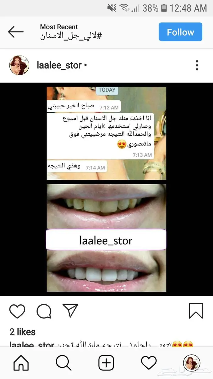 تبييض الاسنان 6