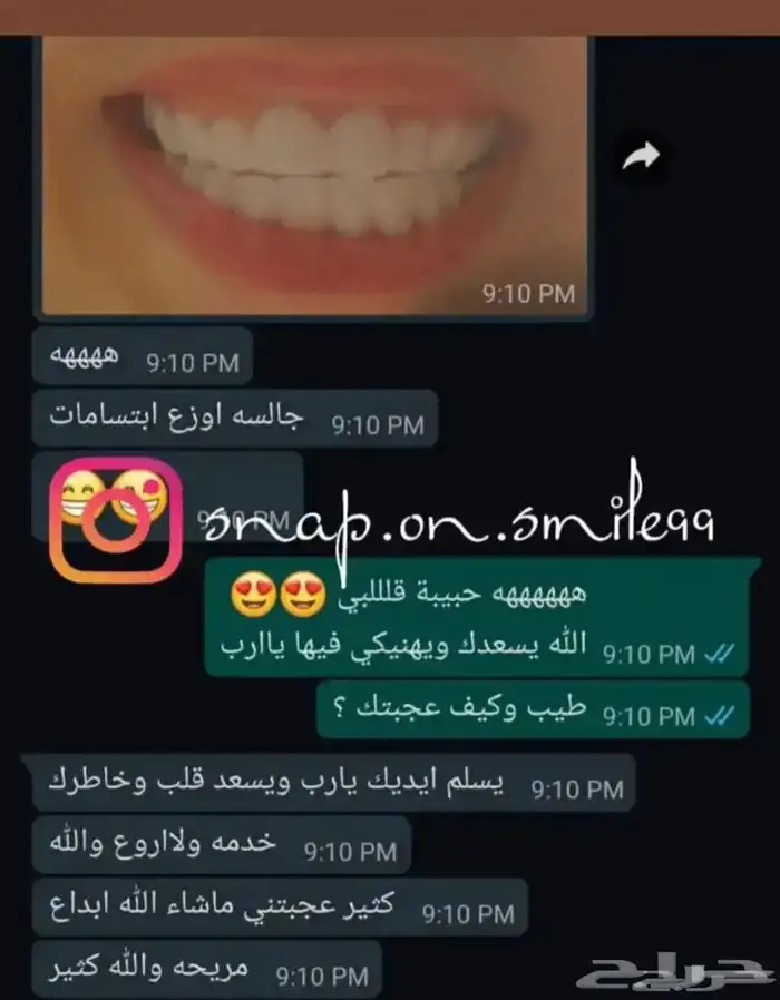 عروض على ابتسامه هوليود المتحركه سناب اون سمايل متوفر اقساط 4