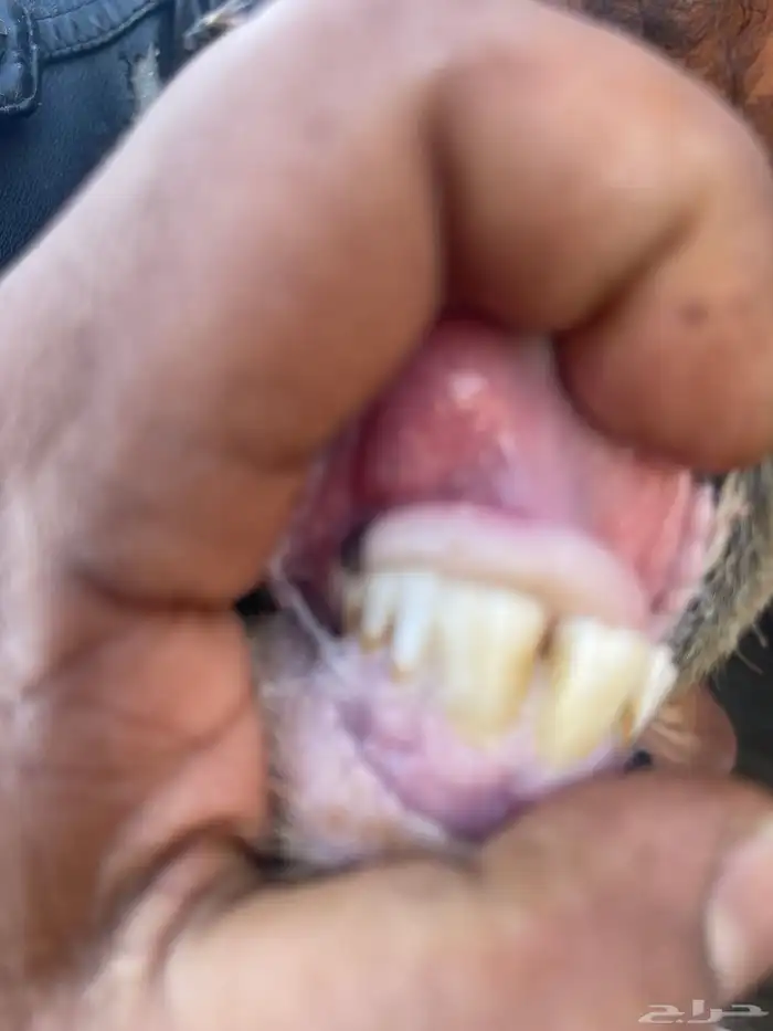 ثنيه مشروكه 0