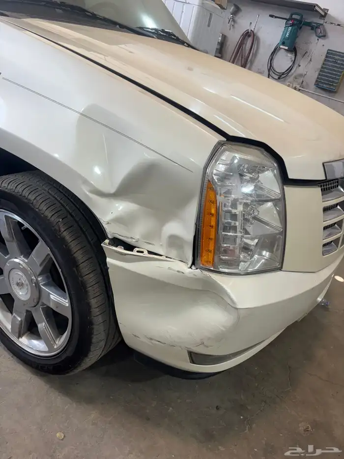 شفط و تعديل علي البارد 0