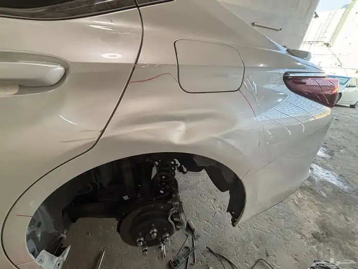 شفط و تعديل علي البارد 6