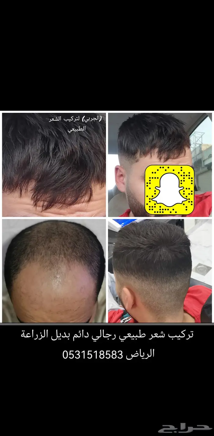 باروكه لصق رجالي دائم 7