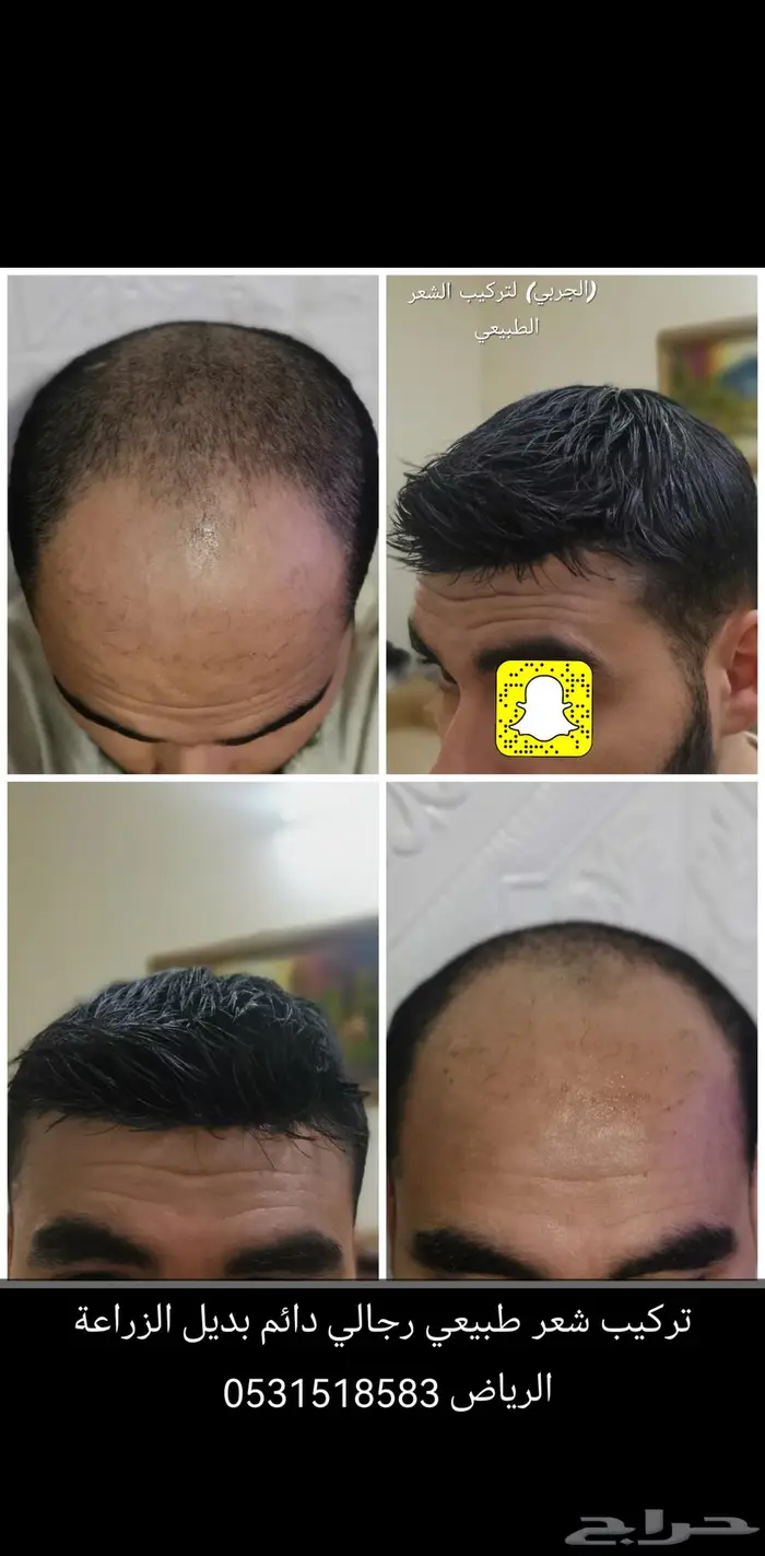 باروكه لصق رجالي دائم 4
