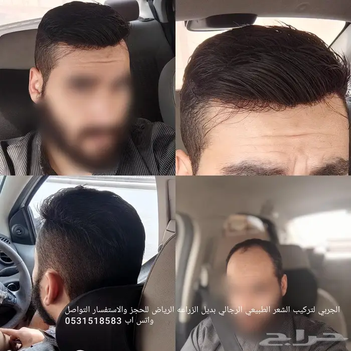باروكه لصق رجالي دائم 1