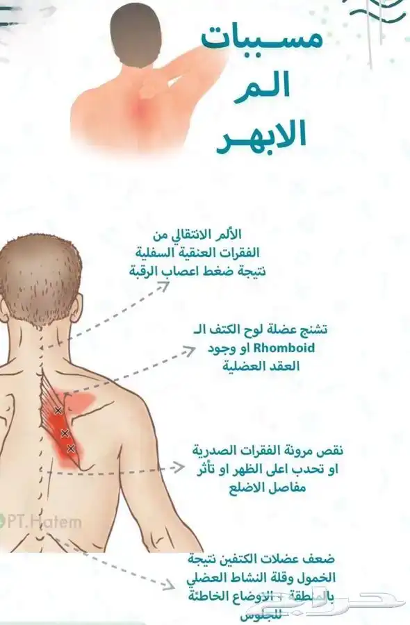 طق ابهر مصع 0