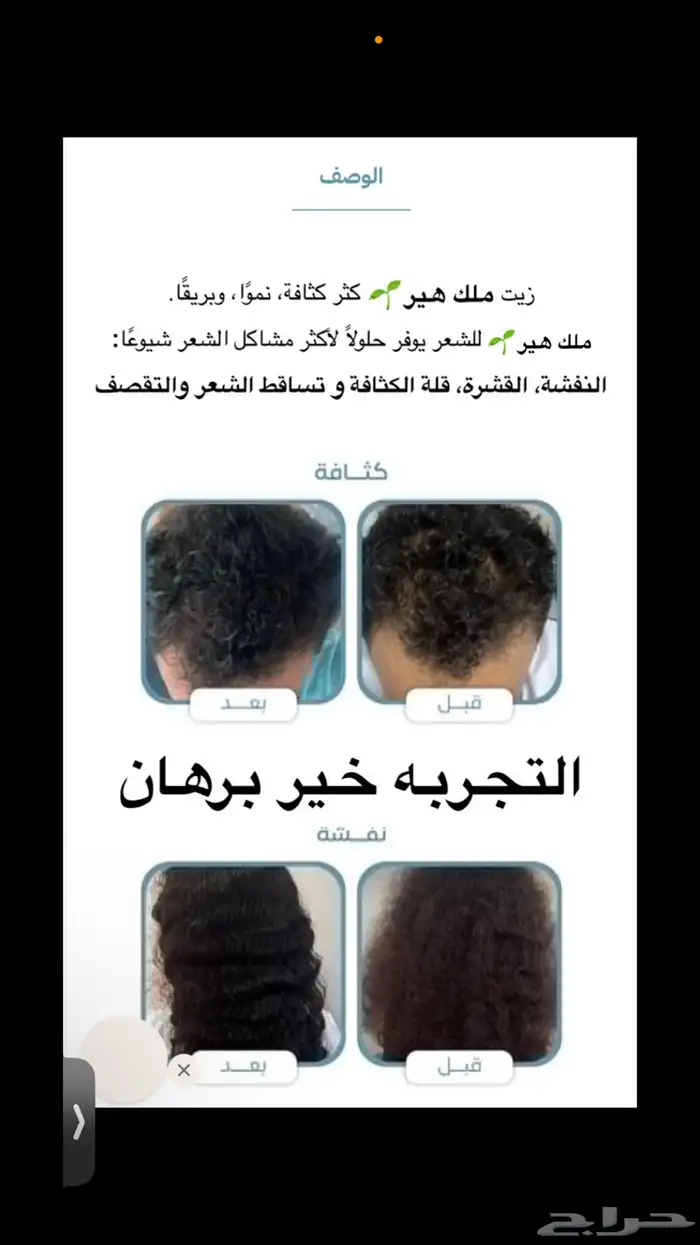 زيت شعر لجميع مشاكل الشعر 0